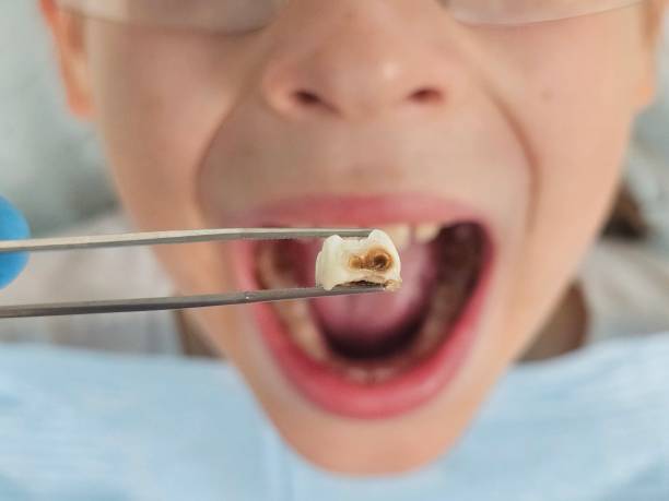 Best Emergency Gum Treatment in Sugar Land, TX
